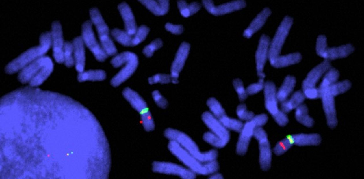 FDA разрешило применение лекарства от врожденных мышечных дистрофий по ускоренной процедуре