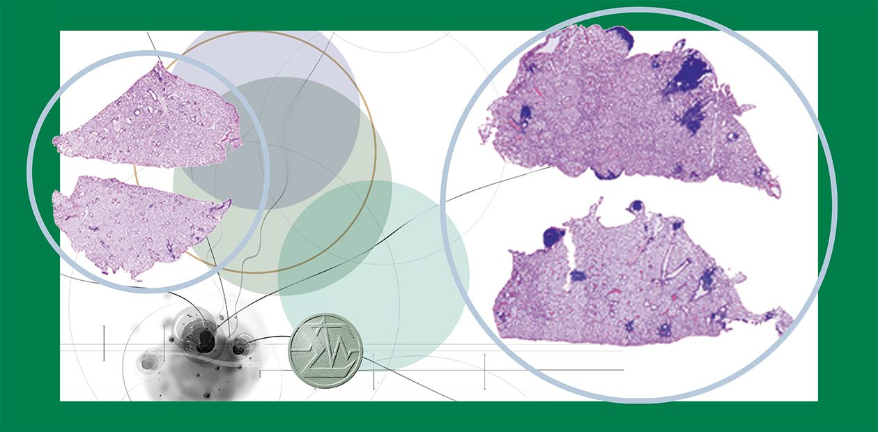 Nucleases against Metastases