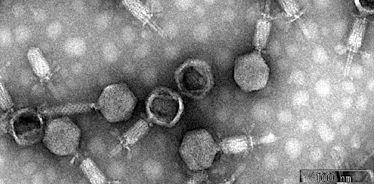 Бактериофаг IME285, специфично поражающий бактерию Acinetobacter baumannii – одного из ключевых возбудителей внутрибольничных инфекций (сепсис, пневмонию, ревмокардит и др.) на фоне ослабленного иммунитета, после операций или при использовании инвазивных устройств. Электронная микроскопия. По: (Wang et al., 2020) Бактериофаг IME285, специфично поражающий бактерию Acinetobacter baumannii – одного из ключевых возбудителей внутрибольничных инфекций (сепсис, пневмонию, ревмокардит и др.) на фоне ослабленного иммунитета, после операций или при использовании инвазивных устройств. Электронная микроскопия. По: (Wang et al., 2020)