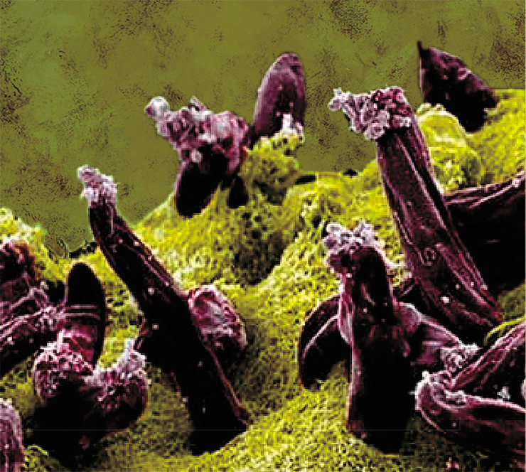 Плазмодий Plasmodium gallinaceum, вызывающий малярию у домашней птицы, в тканях малярийного комара. © NIH Плазмодий Plasmodium gallinaceum, вызывающий малярию у домашней птицы, в тканях малярийного комара. © NIH