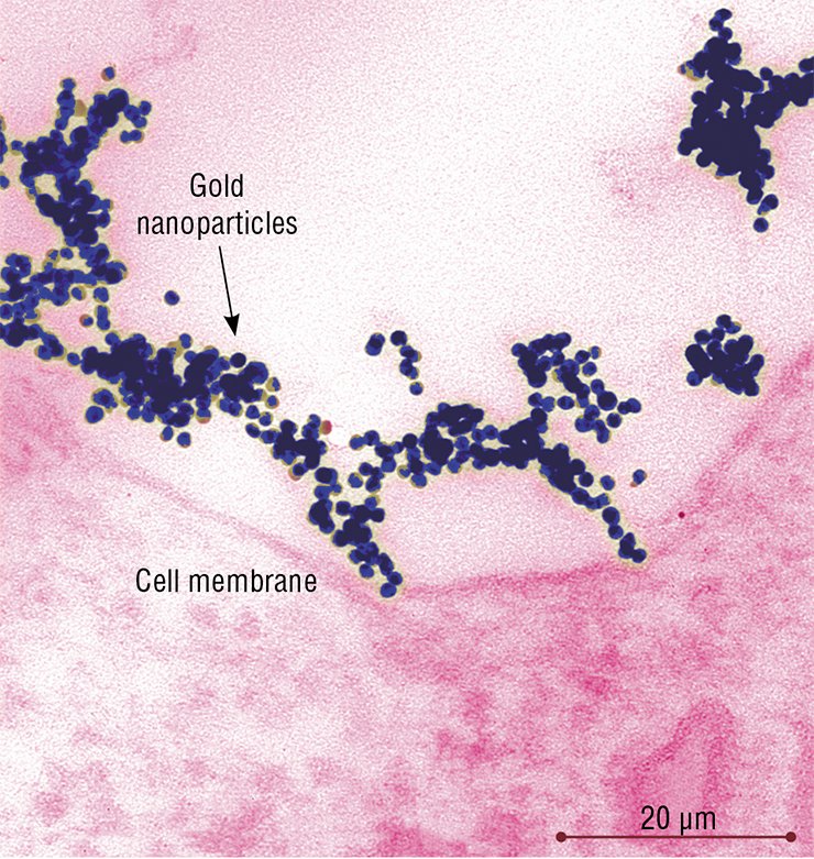 At 10 º C, the temperature which arrests the uptake of substances by the cell, gold nanoparticles rapidly form loose associations the size of up to 2.5 µm. Fancy figures of thousands of nanoparticles contact the cell plasma membrane At 10 º C, the temperature which arrests the uptake of substances by the cell, gold nanoparticles rapidly form loose associations the size of up to 2.5 µm. Fancy figures of thousands of nanoparticles contact the cell plasma membrane