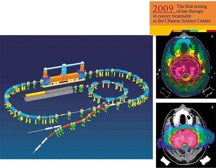Project of a carbon complex for treating cancer by the electron cooling method. Carbon ions are accelerated in a small linear accelerator and injected into the ring booster. From there they are directed to the main ring with electron cooling, where they are accumulated and then directed to distribution channels by means of cooling. Computer plan of dose distribution obtained by using X-ray therapy from nine directions (a) and carbon therapy from two directions (b). One can see that the dose received by healthy tissues is much greater in the case of X-ray therapy as compared with ion therapy. A clearer contour of the high dose in the case of ion therapy shows a good therapeutic effect owing to fast recovery of the tumor-adjacent tissues Project of a carbon complex for treating cancer by the electron cooling method. Carbon ions are accelerated in a small linear accelerator and injected into the ring booster. From there they are directed to the main ring with electron cooling, where they are accumulated and then directed to distribution channels by means of cooling. Computer plan of dose distribution obtained by using X-ray therapy from nine directions (a) and carbon therapy from two directions (b). One can see that the dose received by healthy tissues is much greater in the case of X-ray therapy as compared with ion therapy. A clearer contour of the high dose in the case of ion therapy shows a good therapeutic effect owing to fast recovery of the tumor-adjacent tissues