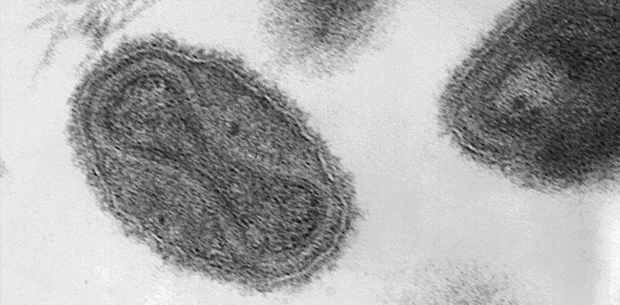 В вирионах вируса натуральной оспы наследственная информация хранится в структуре в виде гантели. При попадании в клетку вирусная ДНК высвобождается и служит матрицей для синтеза новых вирусных частиц. Public Domain В вирионах вируса натуральной оспы наследственная информация хранится в структуре в виде гантели. При попадании в клетку вирусная ДНК высвобождается и служит матрицей для синтеза новых вирусных частиц. Public Domain