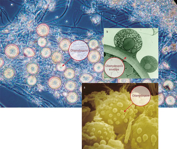 The fungi are distinguished by their complex life cycles and variety of reproduction methods. The most important life form for the predatory fungi is chlamydospore – survival structure of predator covered by the thick envelope which serves as a vegetative analogue of the true conidium seeds. Photo shows: external view (а) and fragment of internal structure (b) of chlamydospore Duddingtonia flagras (c). Light and electron microscopy The fungi are distinguished by their complex life cycles and variety of reproduction methods. The most important life form for the predatory fungi is chlamydospore – survival structure of predator covered by the thick envelope which serves as a vegetative analogue of the true conidium seeds. Photo shows: external view (а) and fragment of internal structure (b) of chlamydospore Duddingtonia flagras (c). Light and electron microscopy