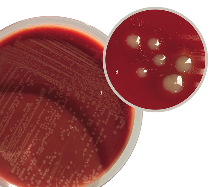 Колонии гемофильной палочки (Haemophilus influenza) на питательной среде: шоколадном (а) и кровяном (б) агаре. © CC BY-SA 4.0/Manurx27 и CC BY-SA 4.0/Deminorwood Колонии гемофильной палочки (Haemophilus influenza) на питательной среде: шоколадном (а) и кровяном (б) агаре. © CC BY-SA 4.0/Manurx27 и CC BY-SA 4.0/Deminorwood