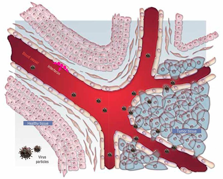 In the norm, the very architecture of tissues is a strong barrier hindering penetration of a virus and its cell-to-cell travel. In addition, healthy cells respond to infection by producing the antiviral protein interferon, rendering the adjacent cells resistant to virus infection.As for the tumor, this is a chaotic mass of poorly contacting cells, which are handy for virus particles coming from the blood stream to adsorb. Moreover, tumor cells frequently lose the mechanisms underlying antiviral protection, including the ability to produce interferon.For viruses, tumor cells are also the best substrate for reproduction, since they are actively dividing and their biosynthetic processes necessary for virus replication have been triggered