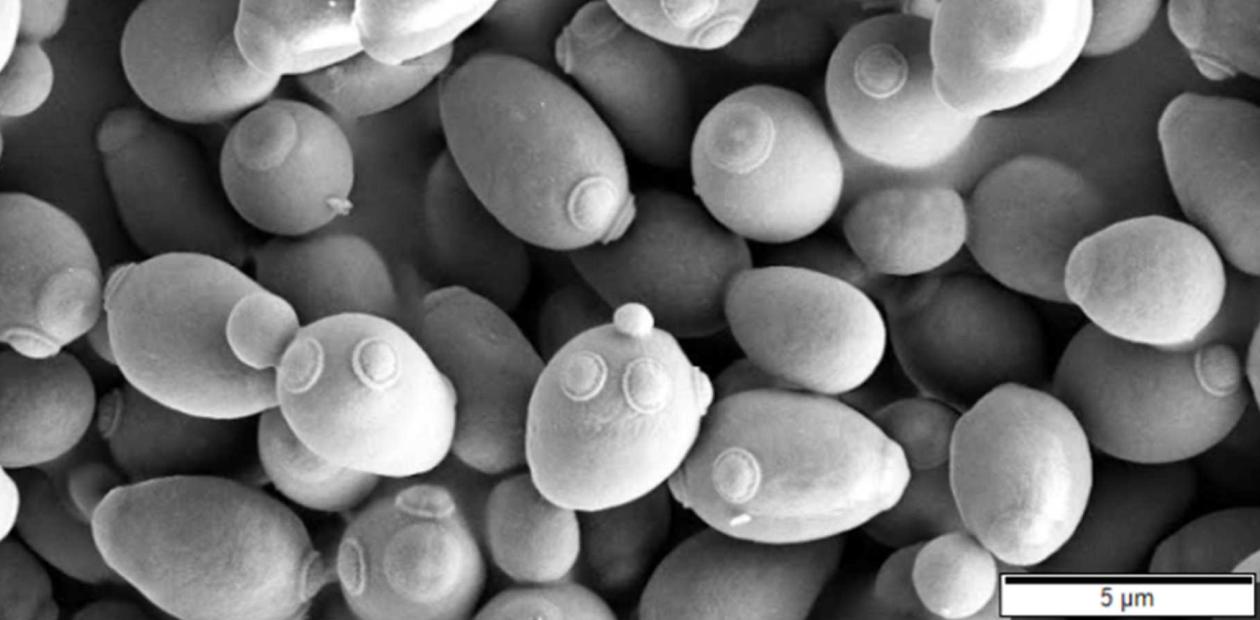 Почкование дрожжей Saccharomyces cerevisiae. Сканирующая электронная микроскопия Почкование дрожжей Saccharomyces cerevisiae. Сканирующая электронная микроскопия