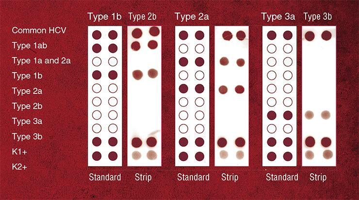 An example of the results of biochip genotyping of hepatitis C virus (HCV). The test is used to classify the viral material in the clinical sample into one of the six diagnostically significant subtypes: 1a, 1b, 2a, 2b, 3a, 3b. The biochip is made of a nylon strip carrying a set of specific oligonucleotide probes. This design allows analyzing several regions in the viral DNA simultaneously. To assess the threat the virus poses for the patient, the viral subtype is determined by comparison of the staining pattern on a developed biochip with the standard pattern. C1+, control for the probe labeling system; C2+, control for the label staining system. Image courtesy of E. Dmitrienko (SB RAS ICBFM)