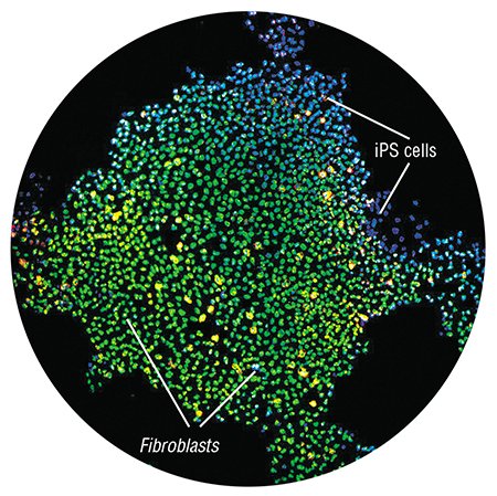 Pluripotent stem cells can be derived from various differentiated body cells, such as blood cells or fibroblasts (skin cells). Fluorescence microscopy. Photo by the courtesy of J. Yu (University of Wisconsin School of Medicine and Public Health, Morgridge Institute for Research in Madison, United States)