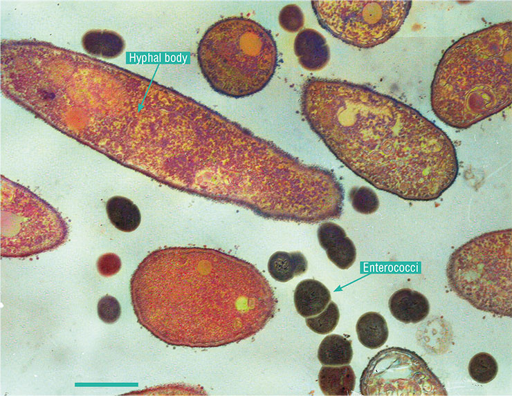Image of the hemolymph of a wax moth larva with a combined infection caused by the fungus Cordyceps militaris and the bacterium Enterococcus faecalis shows fungal hyphal bodies and bacterial cells. Electron microscopy. Photo by A. Miller. Color retouching by the editors