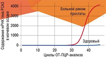 Для молекулярной диагностики рака простаты обычно используют маркер ПСА (простатспецифический антиген). Однако намного более специфичным маркером злокачественной трансформации является белок PCA3, т. к. ген PCA3 не активируется в случае доброкачественной гиперплазии и воспалительных процессов в простате. Поэтому в случае неоднозначного диагноза (а на сегодняшний день речь идет о семи случах из десяти) хорошим критерием целесообразности биопсии служит наличие в моче самого белка PCA3 либо матричной РНК гена PCA3, которая содержит информацию об аминокислотной последовательности белка (вверху). Работа выполнена Н. А. Оськиной и У. А. Боярских (группа фармакогеномики ИХБФМ СО РАН, Новосибирск)