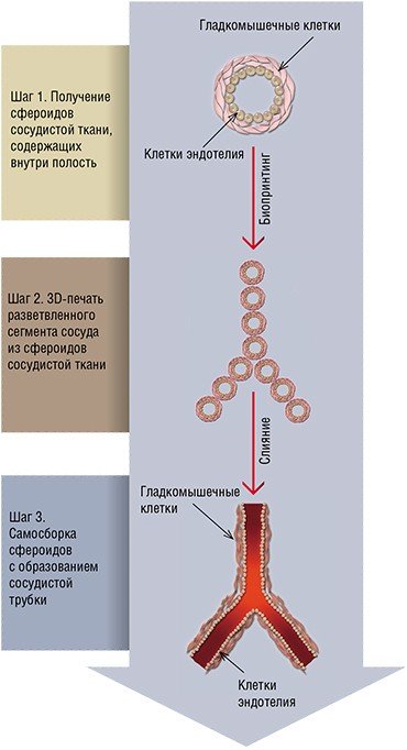 Важнейший этап в развитии биопринтинга – «печатание» органов со встроенной сосудистой сетью