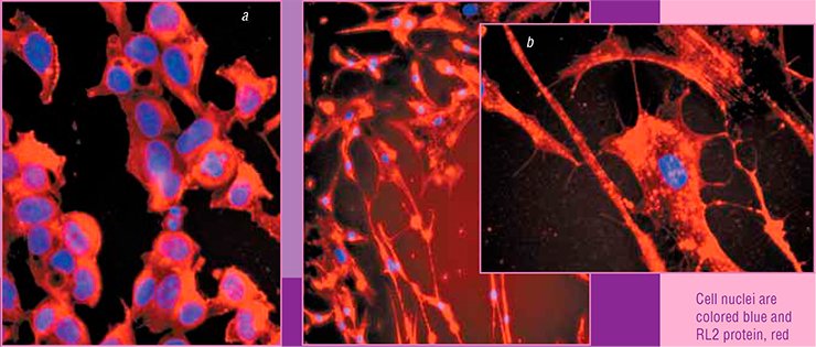 Treatment of (a) MCF-1 and (b) MSC human breast cancer cell lines with RL2 protein initiates apoptosis; in this process, RL2 binds to cell cytoskeletal proteins, thereby provoking destruction of the mitochondrial membranes. Fluorescence microscopy Treatment of (a) MCF-1 and (b) MSC human breast cancer cell lines with RL2 protein initiates apoptosis; in this process, RL2 binds to cell cytoskeletal proteins, thereby provoking destruction of the mitochondrial membranes. Fluorescence microscopy