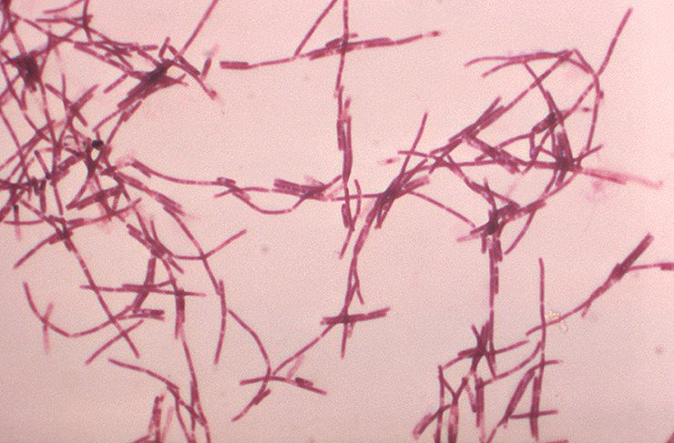 Бактерии Bacillus anthracis, вызывающие сибирскую язву у животных (овец, коз и крупного рогатого скота) и человека, обнаруживаются в почве во многих частях мира.На микрофотографии – грамотрицательные палочковидные бациллы B. anthracis, которые, соединяясь друг с другом, образуют длинные нитевидные цепи. CDC, Public Domain Бактерии Bacillus anthracis, вызывающие сибирскую язву у животных (овец, коз и крупного рогатого скота) и человека, обнаруживаются в почве во многих частях мира.На микрофотографии – грамотрицательные палочковидные бациллы B. anthracis, которые, соединяясь друг с другом, образуют длинные нитевидные цепи. CDC, Public Domain