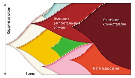 Развитие опухоли начинается с того, что в организме образуются раковые клетки, которые не подвергаются разрушению клетками иммунной системы и начинают размножаться (пролиферировать). Опухоль проходит через несколько стадий своего развития, распространяется по организму, образуя метастазы, а в процессе попыток ее уничтожить образует клоны клеток, нечувствительных к терапии