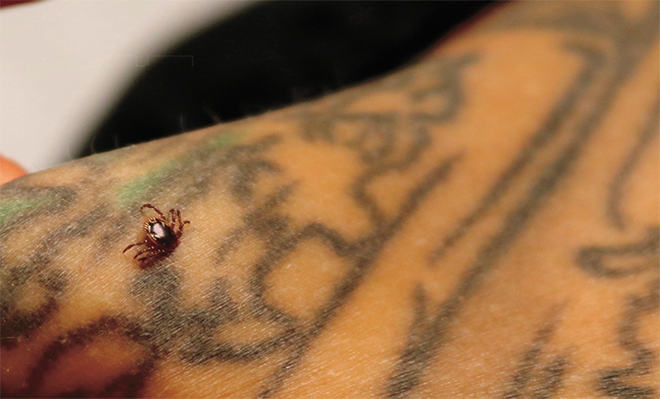A woman from Maryland, in the eastern United States, discovered on her skin a sucking lone star tick (A. americanum), a potential vector of Lyme disease. © NIAID