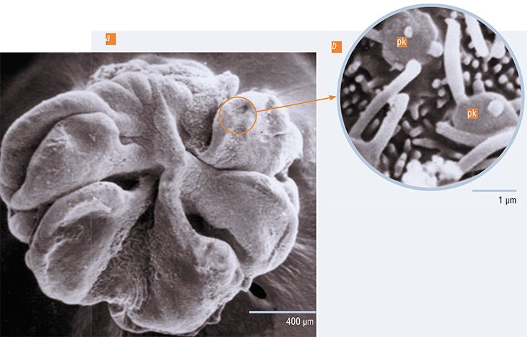In fish, in contrast to humans, olfactory cells are localized in a special flower-like organ, i. e. an olfactory rosette consisting of 5—6 separate petals. The photo shows the olfactory rosette of the yellowfin Baikal sculpin (C. grewingkii); a – general view, b – enlarged fragment of the epithelium with tops of a flagellar-type receptor cell (pk). Electron microscopy In fish, in contrast to humans, olfactory cells are localized in a special flower-like organ, i. e. an olfactory rosette consisting of 5—6 separate petals. The photo shows the olfactory rosette of the yellowfin Baikal sculpin (C. grewingkii); a – general view, b – enlarged fragment of the epithelium with tops of a flagellar-type receptor cell (pk). Electron microscopy