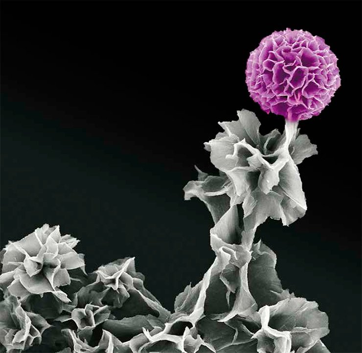 Scanning electron microscopy. Image courtesy of the Materials Research Society (www.mrs.org) Science as Art Competition (spring 2013) and Yue Wang, University of California, Los Angeles, USA Scanning electron microscopy. Image courtesy of the Materials Research Society (www.mrs.org) Science as Art Competition (spring 2013) and Yue Wang, University of California, Los Angeles, USA