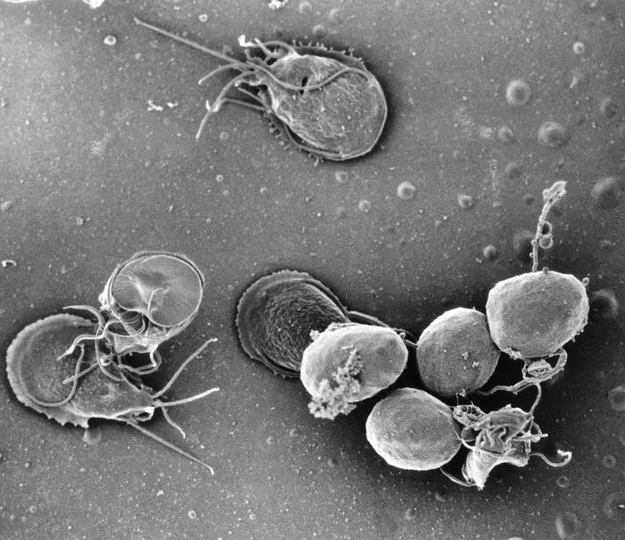 Кишечная лямблия (Giardia lamblia) в культуре. Видны как активные клетки с жгутиками и присоской (трофозоиты), так и созревающие цисты («спящая» форма, внизу справа). Department of Health and Human Services. Public Domain Кишечная лямблия (Giardia lamblia) в культуре. Видны как активные клетки с жгутиками и присоской (трофозоиты), так и созревающие цисты («спящая» форма, внизу справа). Department of Health and Human Services. Public Domain