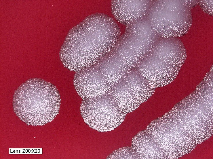 Эти колонии бацилл сибирской язвы Bacillus anthracis штамма Sterne Б, выращенные в течение суток на кровяном агаре при температуре 35 °С, имеют классическую структуру «матового стекла», напоминая груду мелких стеклянных осколков. Первоначально колонии имеют четко очерченные границы, а затем, продолжая расти, сливаются другу с другом. CDC, Public Domain Эти колонии бацилл сибирской язвы Bacillus anthracis штамма Sterne Б, выращенные в течение суток на кровяном агаре при температуре 35 °С, имеют классическую структуру «матового стекла», напоминая груду мелких стеклянных осколков. Первоначально колонии имеют четко очерченные границы, а затем, продолжая расти, сливаются другу с другом. CDC, Public Domain