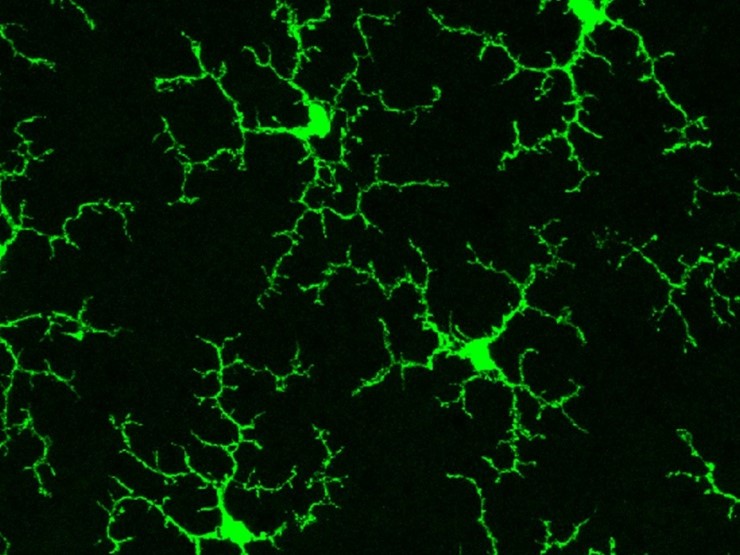 Микроглия в сетчатке здоровой взрослой мыши. Public Domain /Wai T. Wong, National Eye Institute, NIH Микроглия в сетчатке здоровой взрослой мыши. Public Domain /Wai T. Wong, National Eye Institute, NIH