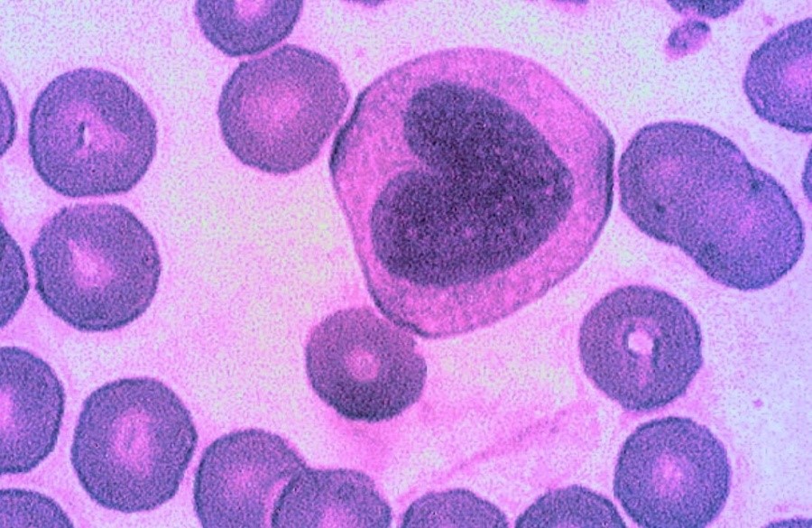 Моноциты – одни из самых крупных клеток крови, которые в норме присутствуют в кровотоке человека. © CC BY-ND 2.0/Magdalena Wiklund Моноциты – одни из самых крупных клеток крови, которые в норме присутствуют в кровотоке человека. © CC BY-ND 2.0/Magdalena Wiklund