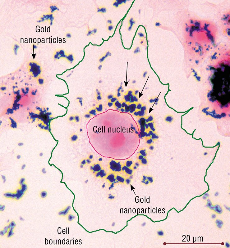 This cell of HeLa culture, growing on glass, takes up gold nanoparticles and accumulates them in its cytoplasm. Light microscopy, eosin staining This cell of HeLa culture, growing on glass, takes up gold nanoparticles and accumulates them in its cytoplasm. Light microscopy, eosin staining