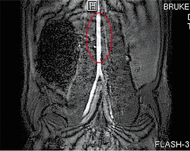 The area with a prosthesis sewed into the rat ventral aorta is seen in this MRT image, captured at the SPF vivarium with the Institute of Cytology and Genetics (Novosibirsk). By the courtesy of A. Akulov and A. Romashchenko