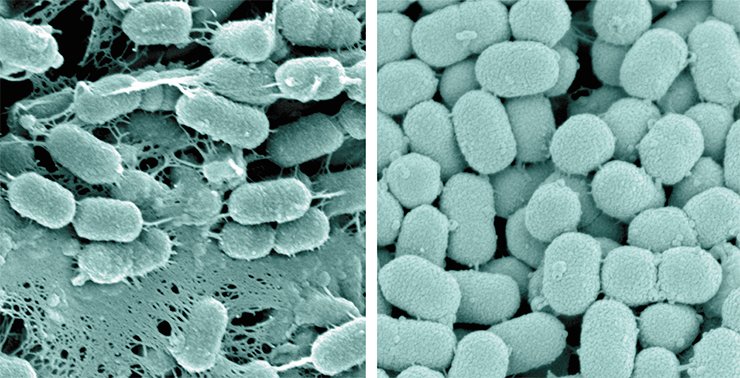 An electron microscopy image of a bacterium belonging to the genus Prevotella, one of the microorganisms determining the human enterotype. One of the strains of these bacteria (left) forms peculiar “networks” which are likely to assist their attaching to intestinal walls. Another strain (right) does not form such structures, which in no way prevents it from flourishing in our intestines An electron microscopy image of a bacterium belonging to the genus Prevotella, one of the microorganisms determining the human enterotype. One of the strains of these bacteria (left) forms peculiar “networks” which are likely to assist their attaching to intestinal walls. Another strain (right) does not form such structures, which in no way prevents it from flourishing in our intestines