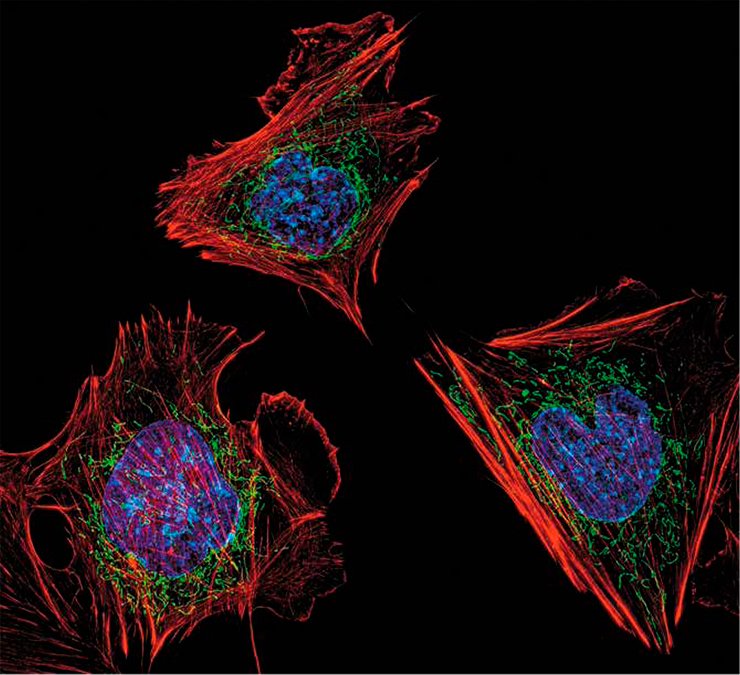 Structured illumination microscopy (SIM) fluorescence; image acquired with a 60x objective. Dylan Burnette, National Institutes of Health, Bethesda, MD, USA. Fifth Prize, 2013 Olympus BioScapes Digital Imaging Competition®. www.OlympusBioScapes.com Structured illumination microscopy (SIM) fluorescence; image acquired with a 60x objective. Dylan Burnette, National Institutes of Health, Bethesda, MD, USA. Fifth Prize, 2013 Olympus BioScapes Digital Imaging Competition®. www.OlympusBioScapes.com