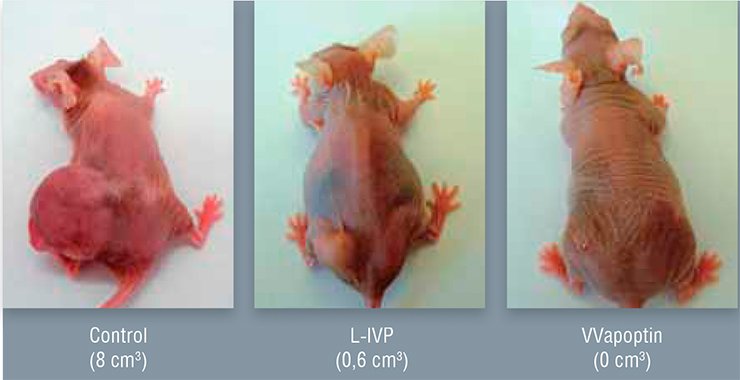 The genetically modified vaccinia virus strain VVapoptin, carrying the inserted gene encoding the protein apoptin, engineered at the State Research Center of Virology and Biotechnology Vector displays a higher cytotoxic effect towards the epidermoid carcinoma cells grafted to thymusless mice as compared with the initial strain L-IVP. Tumor size is parenthesized