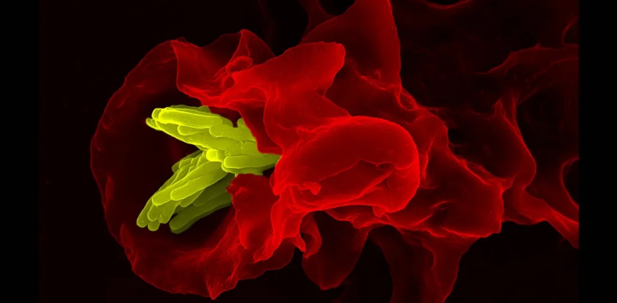 Макрофаг, поглощающий патоген (желтым цветом). © CC BY-NC-ND 2.0/ZEISS Microscopy Макрофаг, поглощающий патоген (желтым цветом). © CC BY-NC-ND 2.0/ZEISS Microscopy