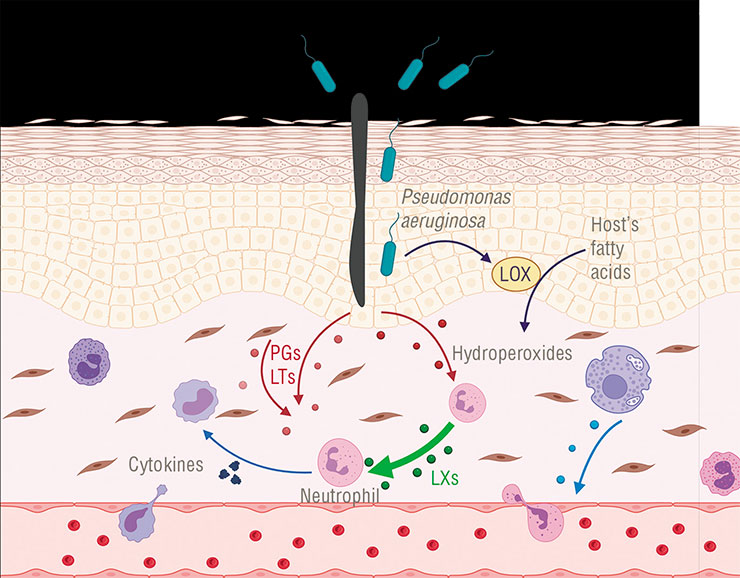 In the case of Pseudomonas aeruginosa, things go differently. The bacterium secretes its own lipoxygenase (LOX), which increases the concentration of fatty acid hydroperoxides – the precursors of lipoxins – in host’s tissues. It leads to excessive synthesis of these substances. As a result, inflammation is suppressed, which facilitates bacterial invasion. Created with BioRender.com