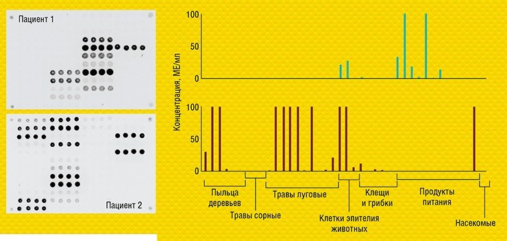 Примеры изображений флуоресцентных картин и соответствующие профили концентраций, полученные при анализе образцов сывороток крови двух пациентов Примеры изображений флуоресцентных картин и соответствующие профили концентраций, полученные при анализе образцов сывороток крови двух пациентов