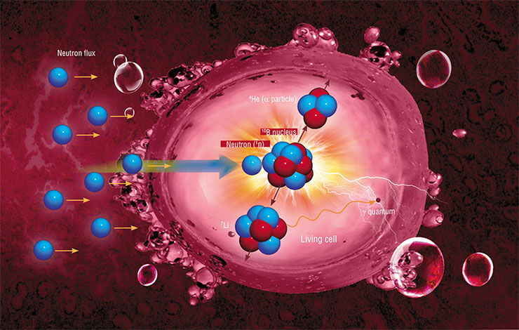 The BNCT action principle on malignant cells is fairly simple. When the neutron hits the boron-10 atom, the unstable product of their merger immediately decays into two fragments flying away from each other with a great velocity. The kinetic energy of the fragments is not enough for them to leave the cell, but before they come to a full stop, they cause an irreversible damage to the cell, leading to its death The BNCT action principle on malignant cells is fairly simple. When the neutron hits the boron-10 atom, the unstable product of their merger immediately decays into two fragments flying away from each other with a great velocity. The kinetic energy of the fragments is not enough for them to leave the cell, but before they come to a full stop, they cause an irreversible damage to the cell, leading to its death