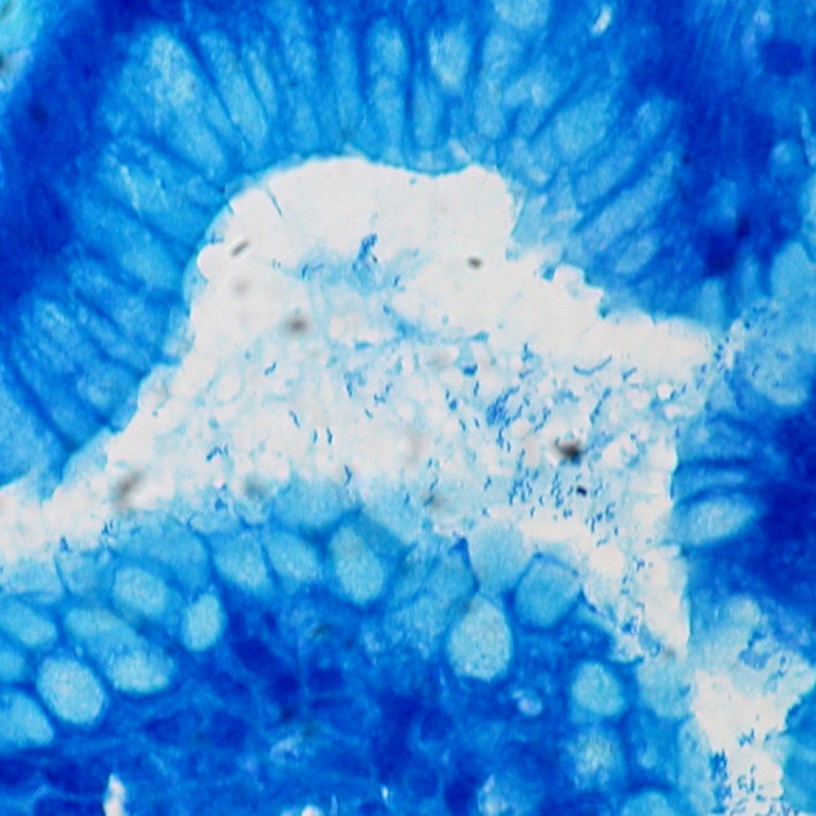 Бактерии Helicobacter pylor в желудке. Биопсийный образец. ©CC BY 2.0/ Ed Uthman