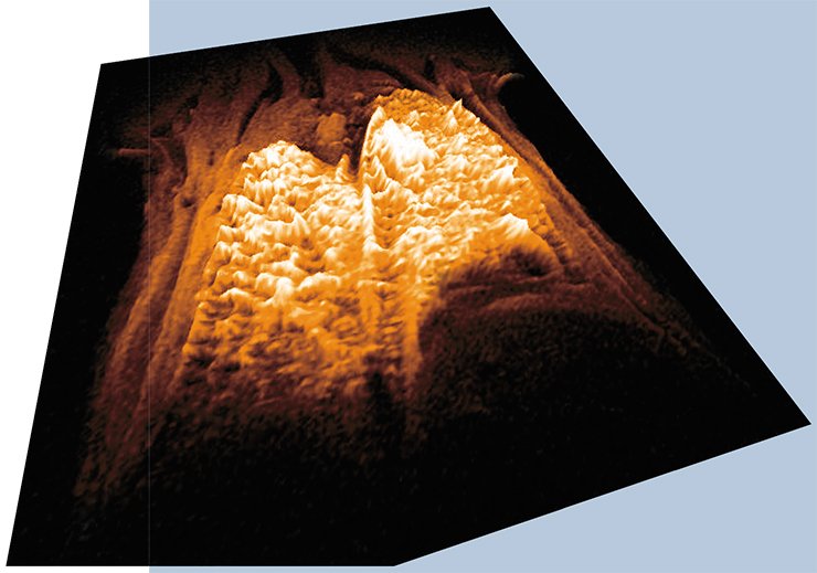 3D image of the intensity of tomography signal from the lungs of a mouse that had inhaled aerosol with iron oxide nanoparticles. Dark regions correspond to the sites of maximum nanoparticle accumulation. Reconstruction based on about 5000 measurements of signal intensity 3D image of the intensity of tomography signal from the lungs of a mouse that had inhaled aerosol with iron oxide nanoparticles. Dark regions correspond to the sites of maximum nanoparticle accumulation. Reconstruction based on about 5000 measurements of signal intensity
