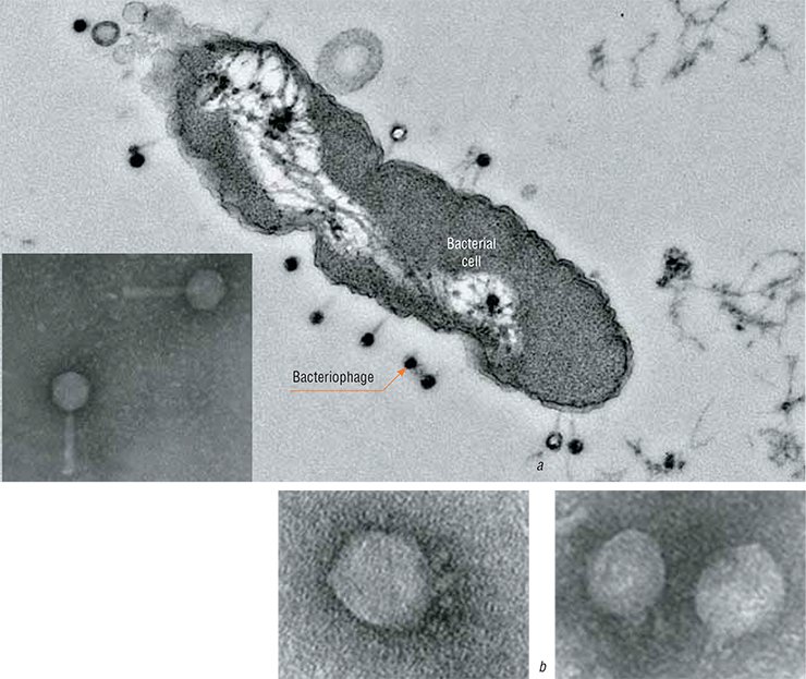 (a) “Tailed” bacteriophages attacking the bacterium Pseudomonas aeruginosa (blue pus bacillus) and (b) the bacteriophages that infect the bacterium Proteus mirabilis, causing urogenital infections, in particular, prostatitis, cystitis, and pyelonephritis. Electron microscopy. By the courtesy of E. I. Ryabchikova (a) “Tailed” bacteriophages attacking the bacterium Pseudomonas aeruginosa (blue pus bacillus) and (b) the bacteriophages that infect the bacterium Proteus mirabilis, causing urogenital infections, in particular, prostatitis, cystitis, and pyelonephritis. Electron microscopy. By the courtesy of E. I. Ryabchikova