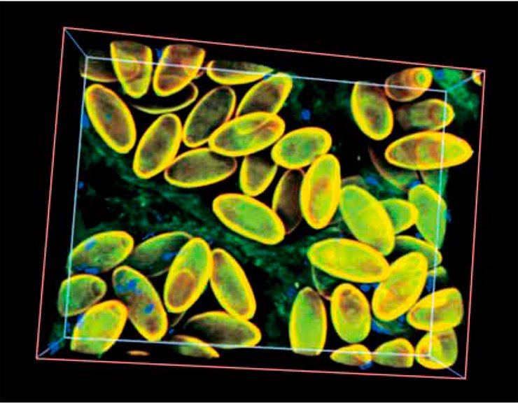 The eggs of different liver fluke species are almost indistinguishable by light microscopy examination, making such diagnostics using laboratory samples rather subjective. Left, 3D reconstruction of liver fluke eggs in the distal part of the trematode uterus. Laser scanning microscopy