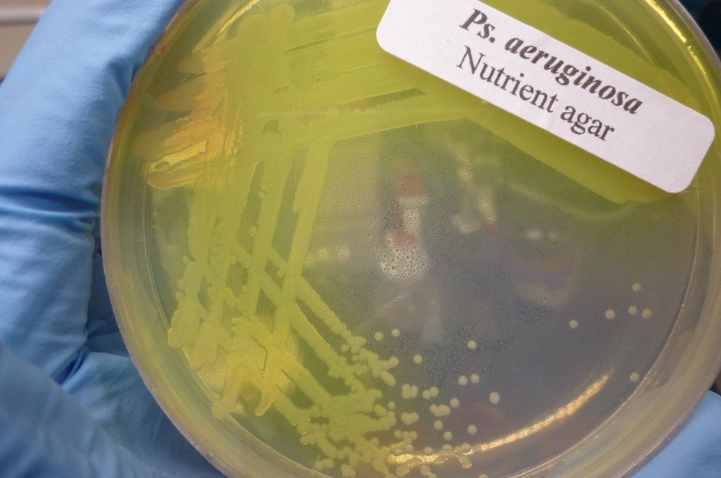 Синегнойная палочка (Pseudomonas aeruginosa) на культуральной среде. © CC BY-SA 3.0/ Sun14916