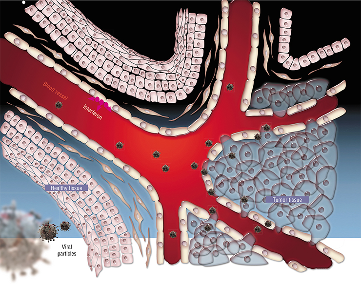 Normally, the very architecture of the living tissue acts as a powerful barrier stopping the virus from entering the body and spreading from cell to cell. Moreover, in response to infection, healthy cells produce and secrete the antiviral protein interferon, which makes adjacent cells insensitive to the viral infection. However, a tumor is a chaotic mass of poorly coordinated cells, which easily adsorb viral particles delivered with the blood flow. For the virus, cancerous cells are the preferred substrate for reproduction, as they actively divide, and the biosynthesis processes necessary for the viral replication are already running in these cells
