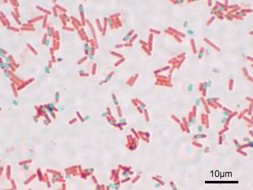 Бактерия Bacillus subtilis. Споры окрашены зеленым. © CC BY-SA 3.0/Y tambe