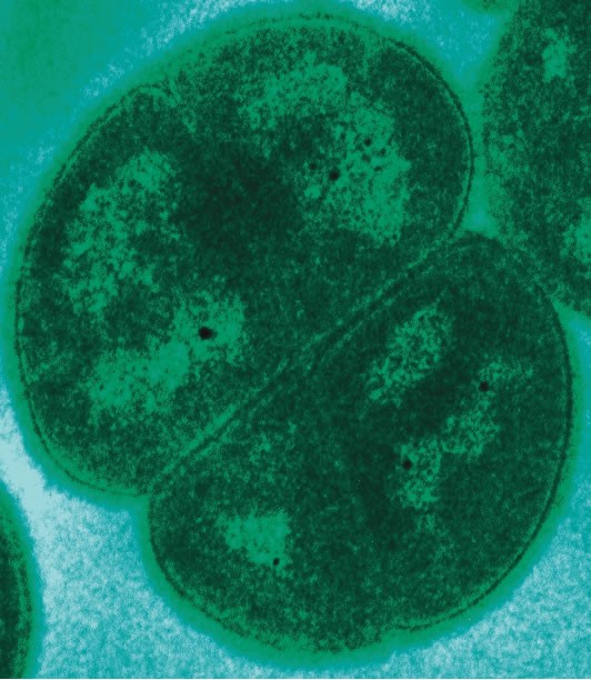 Бактерия Deinococcus radiodurans способна выживать при дозе радиации до 10 000 Гр (для человека летальная доза составляет 5 Гр). Public Domain