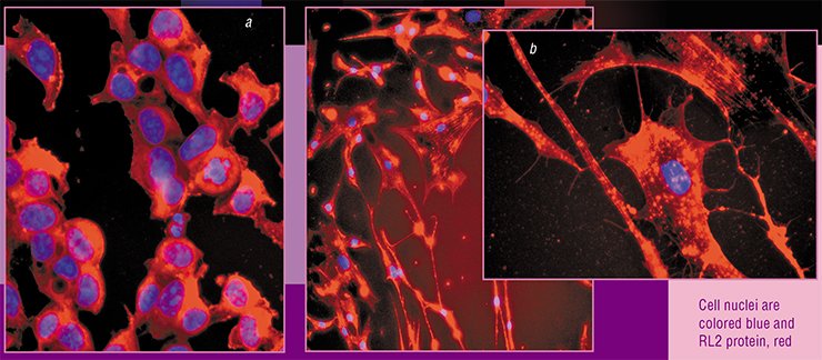 Treatment of (a) MCF-1 and (b) MSC human breast cancer cell lines with RL2 protein initiates apoptosis; in this process, RL2 binds to cell cytoskeletal proteins, thereby provoking destruction of the mitochondrial membranes. Fluorescence microscopy