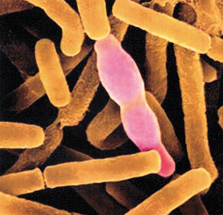 Dividing and spore-forming cells of Bacillus anthracis, anthrax agent