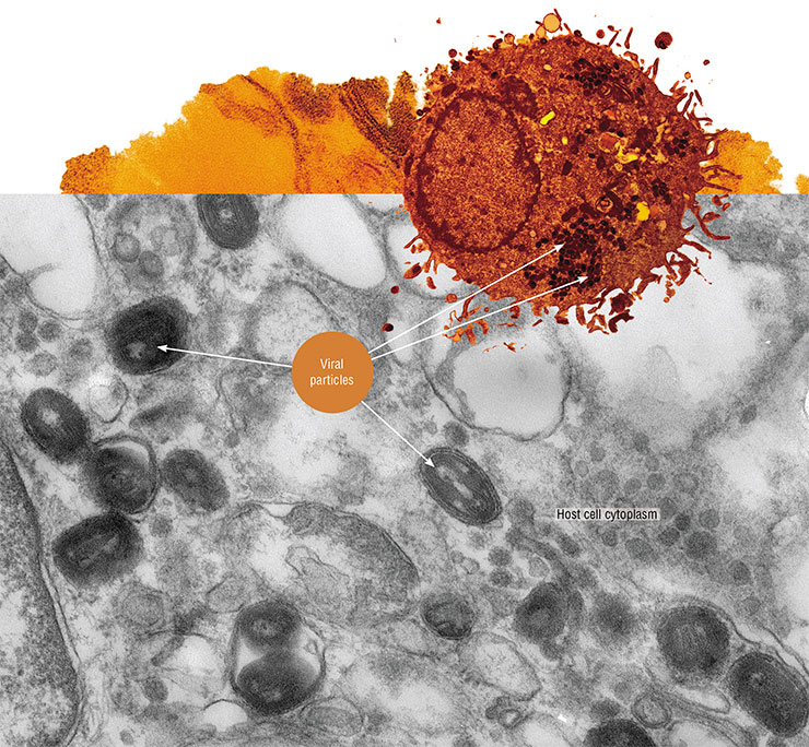 Smallpox (variola) virus virions are large in size, so after special staining, one can see them in a cell using a light microscope, which is impossible for other viruses. The photo shows mature smallpox virions of the India-3a strain in cell cultures. Electron transmission microscopy. Photo by E. Ryabchikova. Adapted from: (Shchelkunov, 2012)
