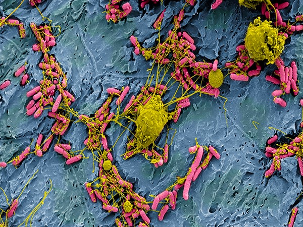 Мочевой пузырь лабораторной мыши, инфицированный бактерией Escherichia coli (розовым цветом) – частая причина инфекции мочевых путей. Лейкоциты (желтым цветом) используют волокнистые внеклеточные ловушки, чтобы обездвижить и убить бактерии. © CC BY-NC 2.0/ NIH Image Gallery Мочевой пузырь лабораторной мыши, инфицированный бактерией Escherichia coli (розовым цветом) – частая причина инфекции мочевых путей. Лейкоциты (желтым цветом) используют волокнистые внеклеточные ловушки, чтобы обездвижить и убить бактерии. © CC BY-NC 2.0/ NIH Image Gallery