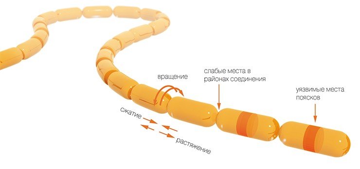 На клетки цепочки у диатомовых водорослей в турбулентной среде могут действовать силы растяжения, сжатия и вращения 