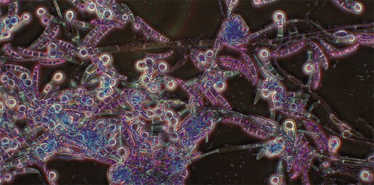 A representative of water moulds – a parasitic species Pythium insidiosum. This fungus-like soil organism is an important animal pathogen and can be carried by dark-winged fungus gnats (Sciaridae). © CC BY-SA 3.0/ Doc. RNDr. Josef Reischig, CSc. A representative of water moulds – a parasitic species Pythium insidiosum. This fungus-like soil organism is an important animal pathogen and can be carried by dark-winged fungus gnats (Sciaridae). © CC BY-SA 3.0/ Doc. RNDr. Josef Reischig, CSc.