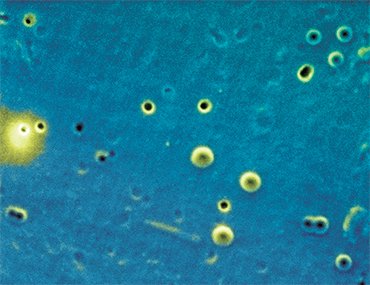 Baikal’s thermophilic facultative anaerobe of the genus Paracoccus, isolated from the sediments of Lake Baikal, formed on solid media small colonies of 1–2 mm consisting of pair or single cells 0.5 microns in diameter. Its ability to utilize peptone (partially hydrolyzed protein) and yeastrel and to grow on a mineral medium in the presence of H₂ and CO₂ proves its microtrophic metabolism, a feature in common with its well-known soil-dwelling “relations.” Scanning electron microscopy. “CIC Ultramicroanalysis” (Irkutsk)